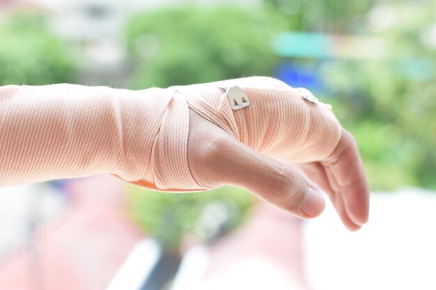 Foto imagen recortada de la mano de una persona con vendaje