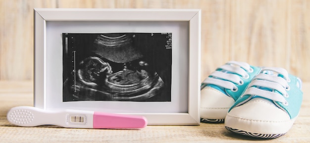 Imagen de ultrasonido de la fotografía y los accesorios de un bebé