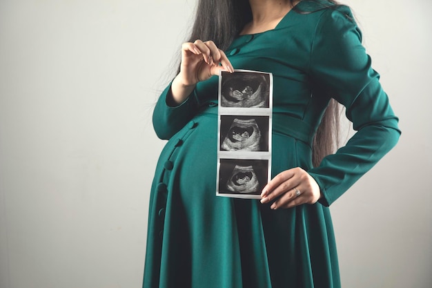 Imagen de ultrasonido de mano de mujer embarazada del bebé