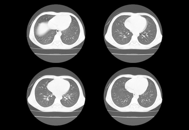 Foto imágenes creativas de tomografía computarizada de tórax y resonancia magnética