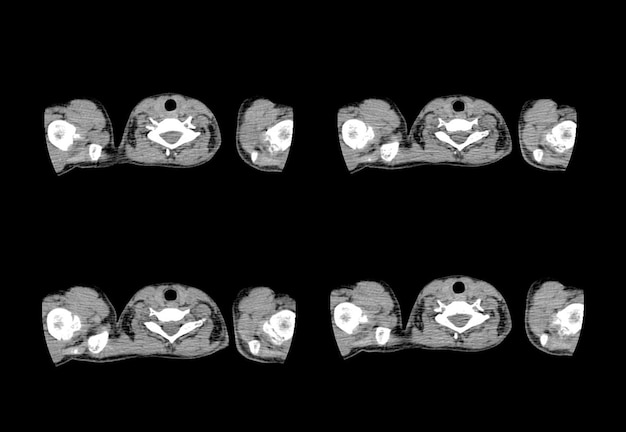 Imágenes creativas de tomografía computarizada de tórax y resonancia magnética