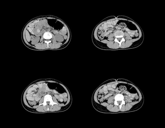 Imágenes profesionales de tomografía computarizada y resonancia magnética de abdomen