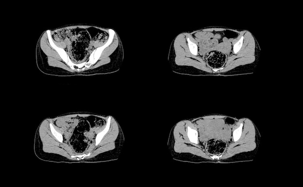 Imágenes profesionales de tomografía computarizada y resonancia magnética de abdomen