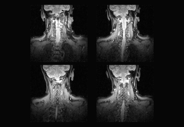 Foto imágenes de resonancia magnética y tomografía computarizada de la columna cervical profesional