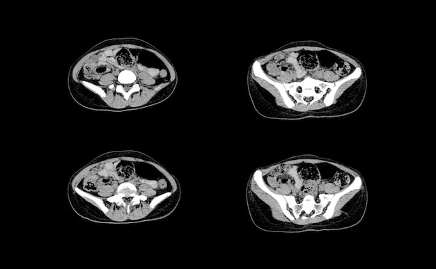 Imagens profissionais de tomografia computadorizada e ressonância magnética do abdômen