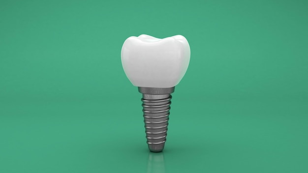 Implante dental Dentadura Fondo verde 3d render