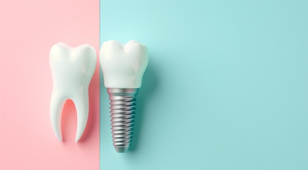 Implante dental con espacio de copia para aclaraciones y beneficios