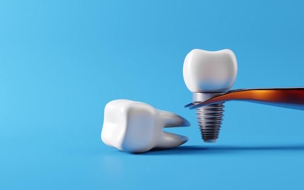 Implantes dentales y caries de raíz Salud oral e inspección dental dientes Herramienta de dentista médico cuidado de la salud infantil