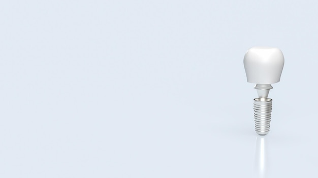 Los implantes dentales para la salud y el concepto médico renderización 3D