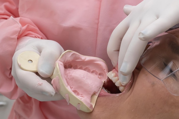 Foto la impresión es el proceso de hacer los moldes de la mandíbula superior e inferior utilizando moldes dentales.