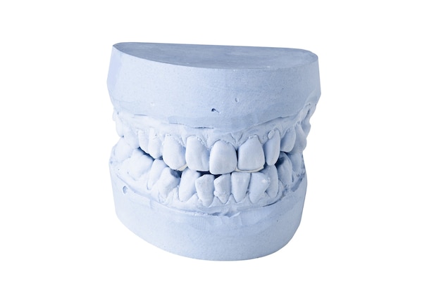 Impressão dentária isolada em fundo branco