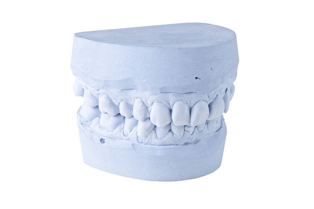 Impressão dentária isolada em fundo branco