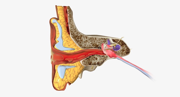 Foto una infección del oído externo también llamada otitis externa