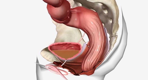 Foto infecções do trato urinário itus