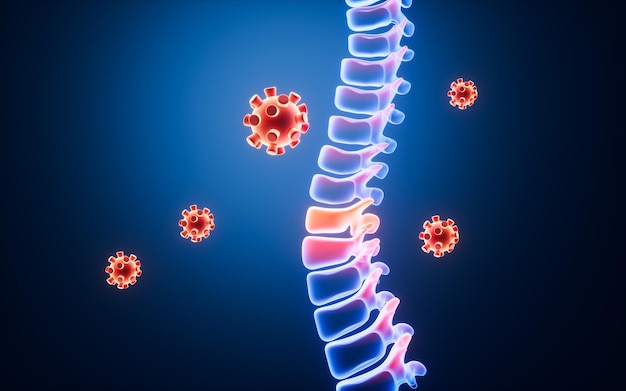 Inflamação da coluna vertebral humana e infecção viral renderização 3D