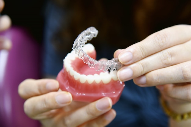 Inivisalign chaves ou alinhador. Conselho do dentista sobre como a ortodontia invisível cria belos dentes na clínica odontológica.