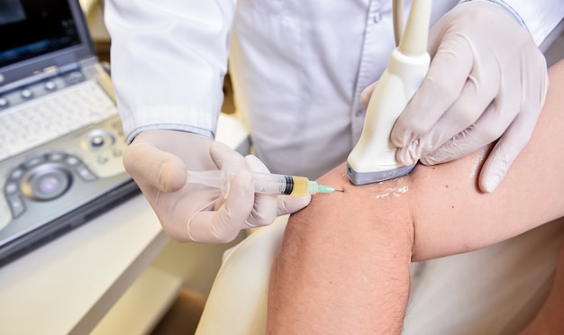 Foto injeção de plasma rico em plaquetas guiada por ultrassom no cotovelo