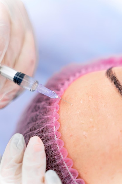 Injektion in die Stirn Selektiver Fokus Zugeschnittenes Foto Schönheitsklinik