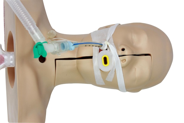 Foto inserción de un tubo de las vías respiratorias endotraqueal para la ventilación asistida que muestra la relación entre
