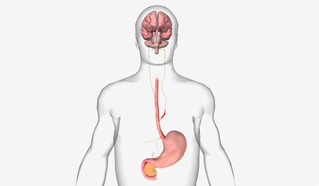 Foto intestino y eje cerebral desregulados