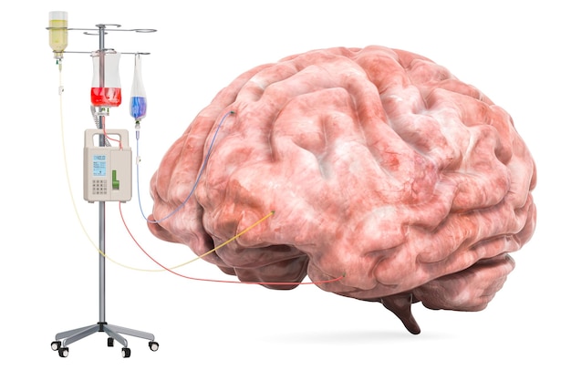 Intravenöses Therapiesystem mit menschlichem Gehirn. Konzept zur Behandlung von Hirnerkrankungen, 3D-Rendering