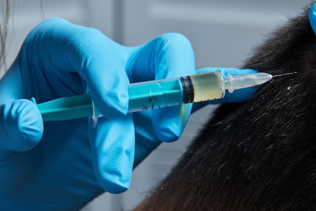 Inyección de plasma en el cabello de la cabeza hombre cosmetólogo médico