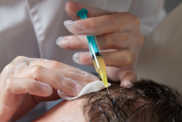 Inyección de plasma en el cabello de la cabeza hombre cosmetólogo médico