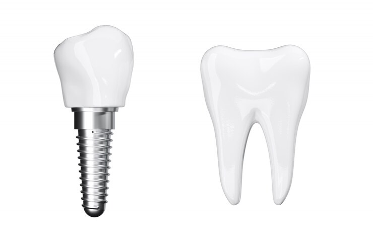 Isolar os implantes de processo próximos com os dentes de beleza branca. Renderização 3D