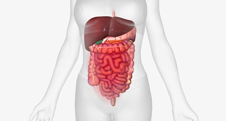 Foto isquemia mesentérica crônica é uma diminuição no fluxo sanguíneo como resultado do estreitamento do vaso principal que alimenta os intestinos