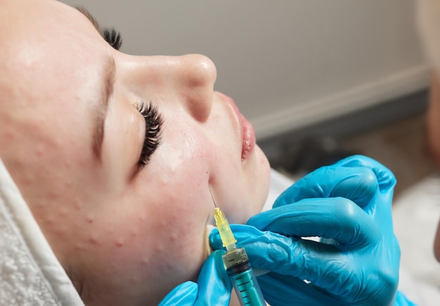 Jeringa con plasma sanguíneo de pacientes en la mano de un cosmetólogo para un plasmolifting facial de una mujer