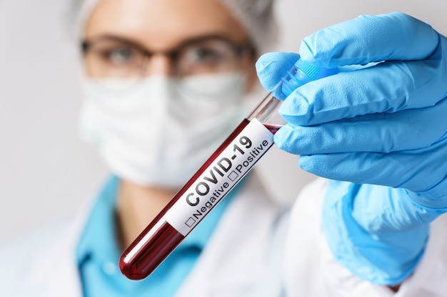 Jovem médica está segurando uma amostra de sangue do COVID-19