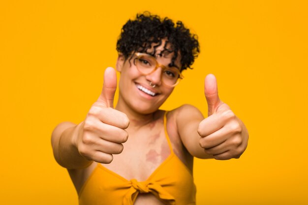 Jovem mulher afro-americana com marca de nascença na pele com polegares para cima, elogios sobre algo, conceito de apoio e respeito.