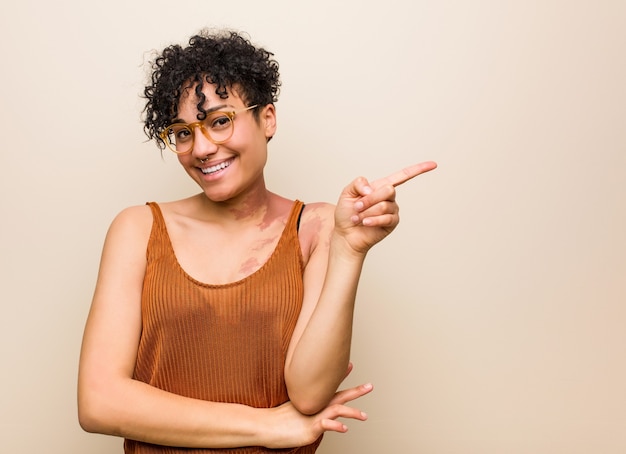 Foto jovem mulher afro-americana com marca de nascença na pele, sorrindo alegremente, apontando com o dedo indicador para longe.