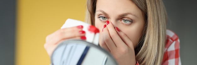 Jovem mulher limpando o nariz com um lenço de papel em frente ao espelho, como evitar o conceito de sangramento nasal