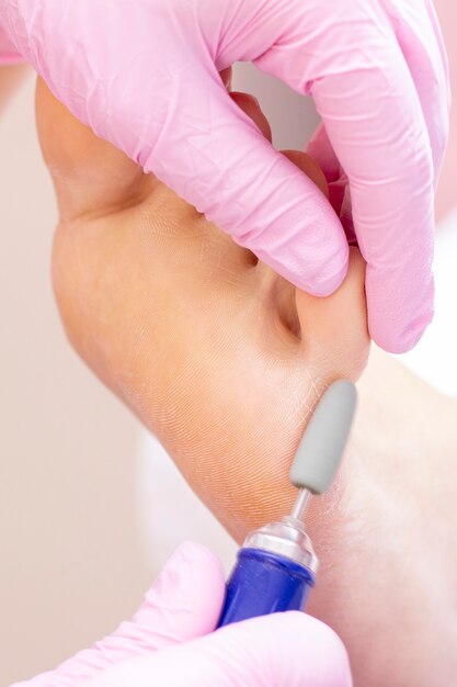 Jovem mulher que obtém o pedicure profissional em um salão de beleza, close up. Salão de beleza profissional. Pedicure, conceito de manicure. rachados e calos nos pés. foto vertical