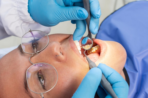Jovem sendo examinada pelo dentista na clínica odontológica Conceito de dentes saudáveis e remédios