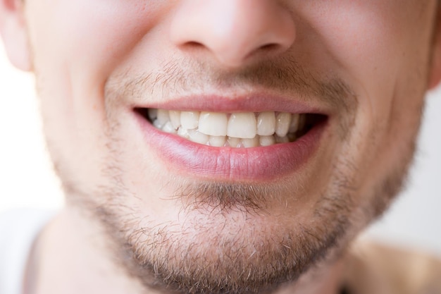 Jovem sorri para a câmera, dentes brancos, lábios e barba