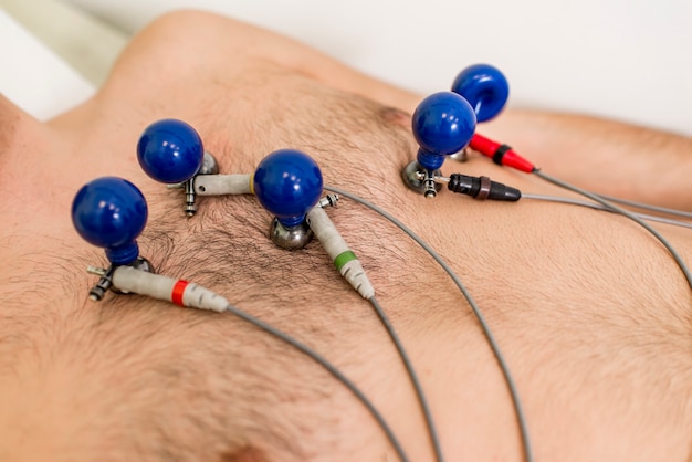 Foto joven haciendo ekg preventivo en el hospital