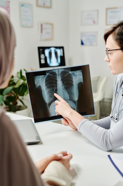 Joven médico explicando los resultados del examen médico de los pulmones a la mujer