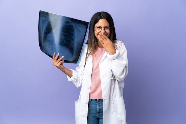 Joven médico mujer sosteniendo una radiografía feliz y sonriente cubriendo la boca con la mano