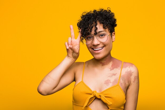 Joven mujer afroamericana con marca de nacimiento de piel que muestra el signo de la victoria y sonriendo ampliamente.