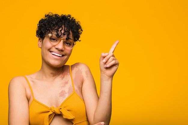 Joven mujer afroamericana con marca de nacimiento de piel sonriendo alegremente apuntando con el dedo lejos.