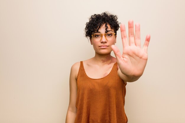 Joven mujer afroamericana con piel marca de nacimiento de pie con la mano extendida que muestra la señal de stop, impidiéndole.