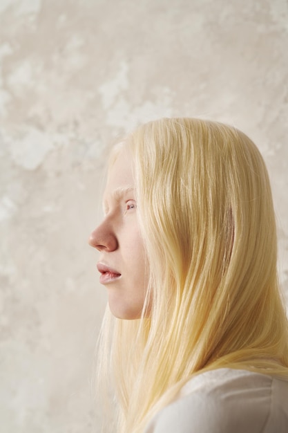 Joven mujer albina serena con cabello largo y liso mirando hacia adelante