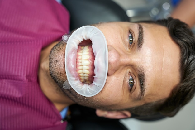 Joven sonriendo ampliamente en sus presas dentales