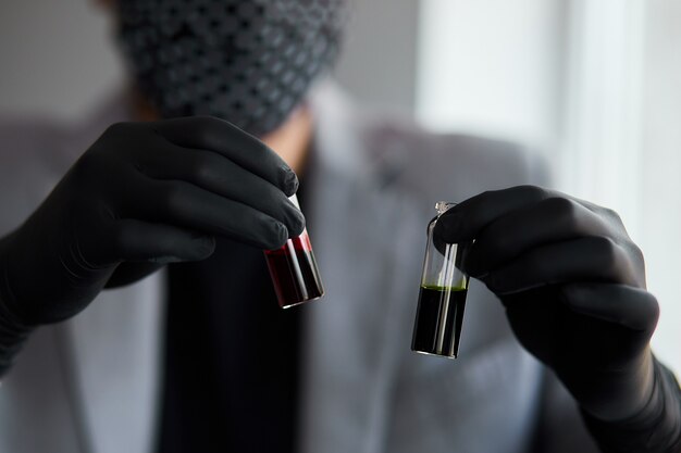 Joven sosteniendo tubos de ensayo con sangre y antídoto en la mano. Tubo de ensayo de sangre con coronavirus.