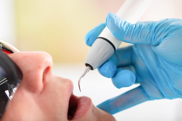 Joven visitando el consultorio dental Manos del dentista en guantes protectores usando ultrasonido para limpiar los dientes del paciente Primer plano de la boca abierta