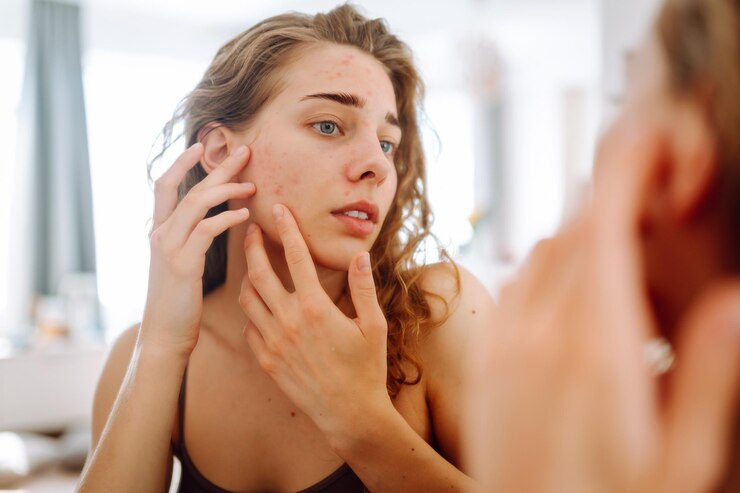 Foto junge frau sieht sich im spiegel an und untersucht entzündungen an ihrem gesicht akne haut medizin und kosmetik