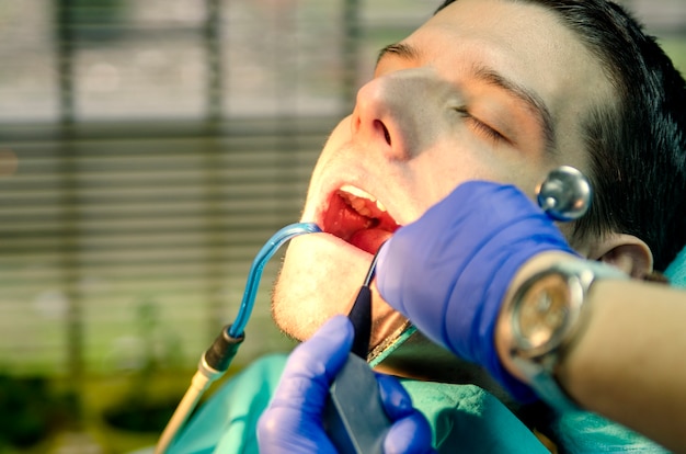 Junger Mann mit offenem Mund im Zahnarztbüro