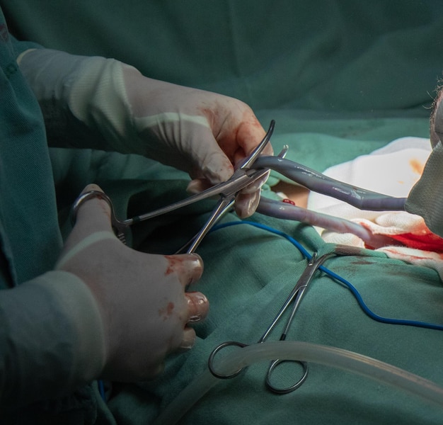 Foto kaiserschnitt-entbindung im krankenhaus